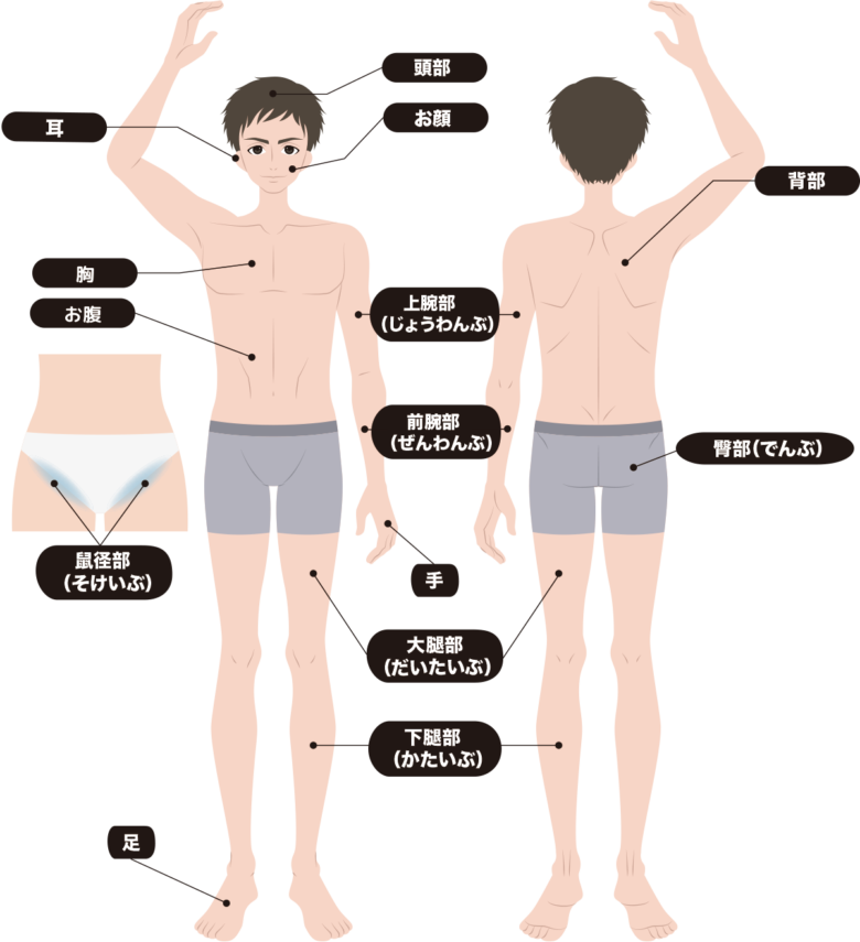 surgery-site_1200_01-1