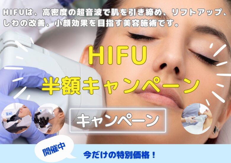 HIFU半額キャンペーン