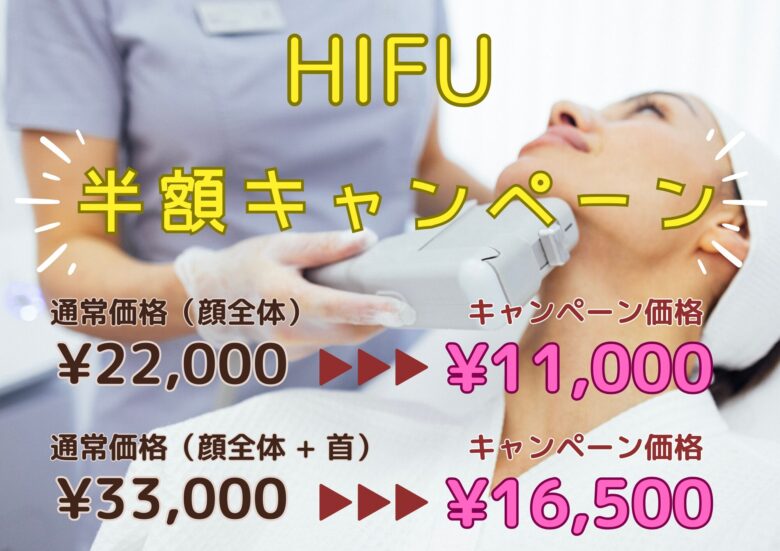 HIFU半額キャンペーン HIFU半額キャンペーン